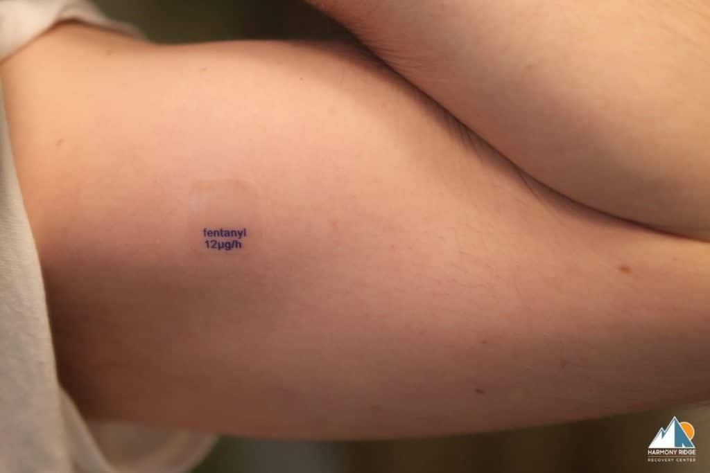 fentanyl patch